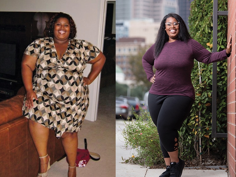 On left is the before picture of woman wearing a dress. On right is after surgery and weight loss picture in stretch pants and a top.