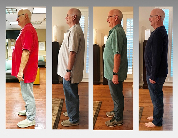 Tracy Edwards' weight-loss transformationafter having a minimally invasive weight-loss procedure at Methodist Dallas.